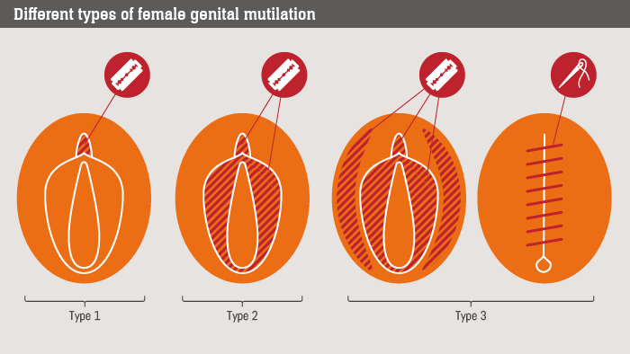 FGM_types_.png